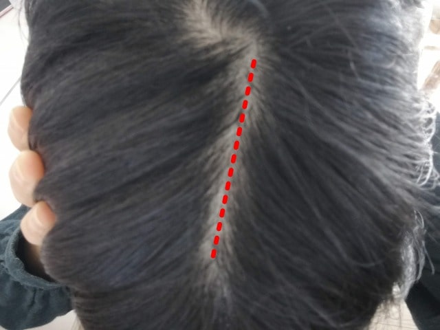 ビフォリアの使い方は3ラインに分ける