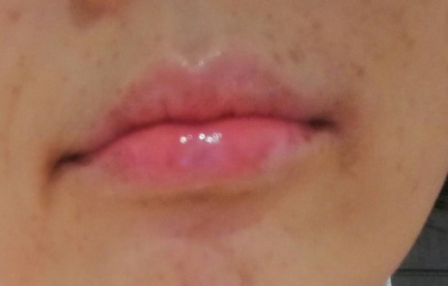 ハリーキスを使ってみた口コミ