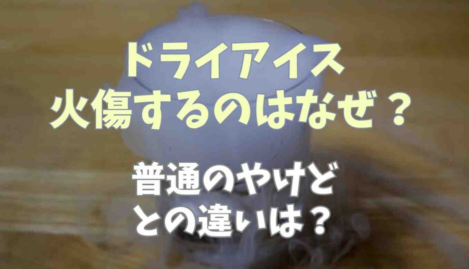 ドライアイス火傷するのはなぜ？普通の火傷との違いは？